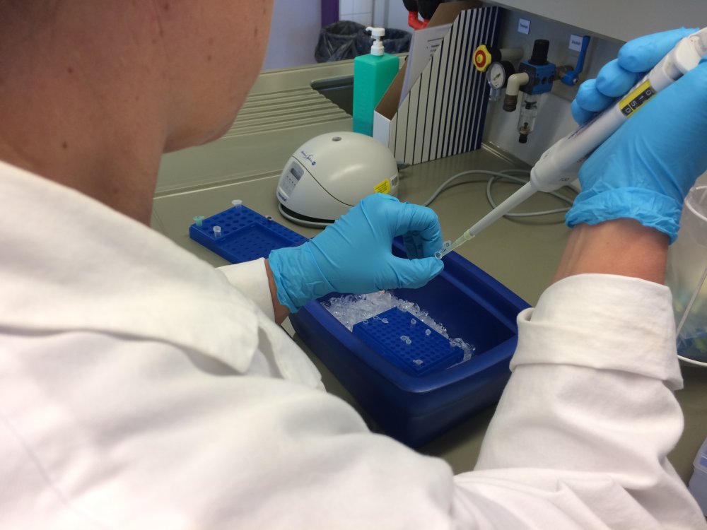 Hände in Handschuhen beim Pipettieren