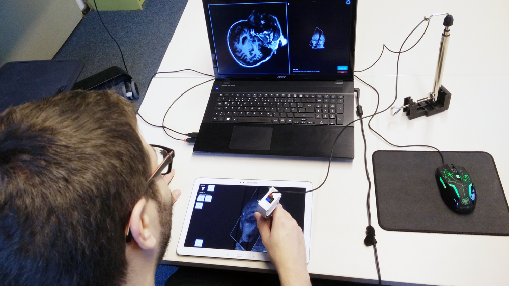 Sitzender Nutzer hält ein stiftartiges Eingabegerät, das mit der Spitze ein auf dem Tisch vor ihm liegendes Tablet berührt. Ein zusätzlicher Computermonitor zeigt ein medizinisches Schnittbild.