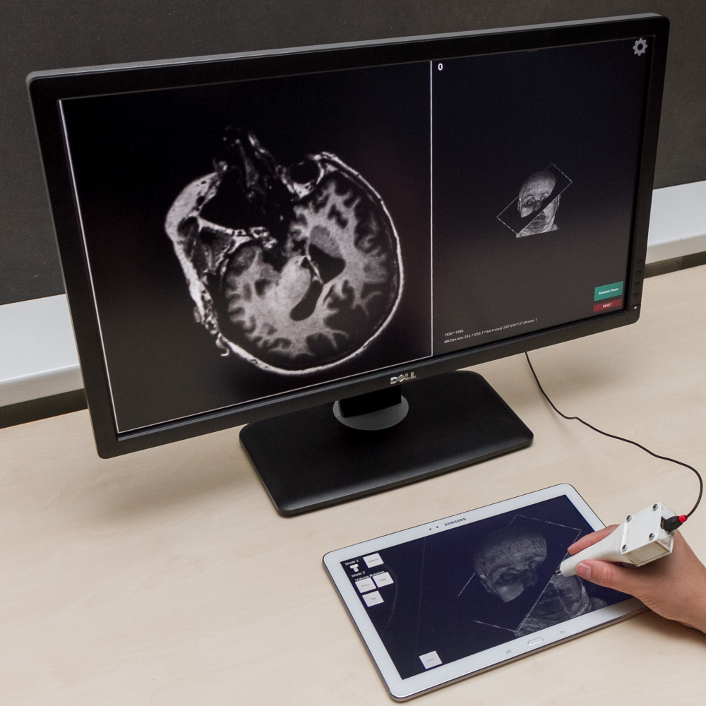 Eine Hand hält ein stiftartiges Eingabegerät, dessen Spitze ein auf einem Tisch liegendes Tablet berührt. Auf dem Tablet ist ein dreidimensionaler Kopf mit einer angedeuteten Schnittebene zu sehen. Ein zusätzlicher Computermonitor zeigt ein radiologisches Schnittbild.