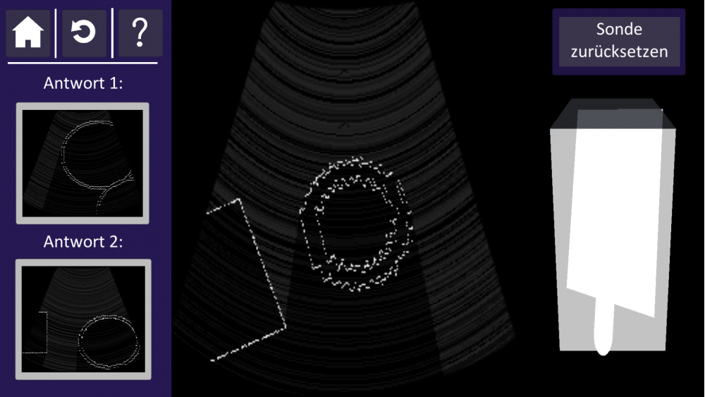 Screenhot der SonoGame App, hier in einem Mini-Game mit ultraschallartigen Schnittbildern