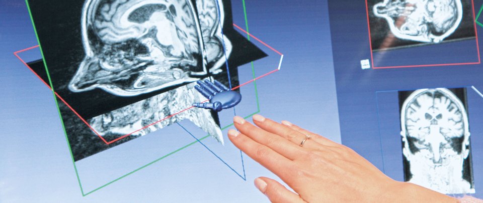 Eine Hand wird flach vor einem Bildfschirm gehalten, auf dem eine virtuelle Hand und 3-dimensionale Röntgenaufnmahmen zu sehen sind.